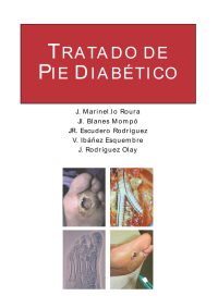  — Tratado Del Pie Diabetico