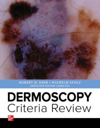 Robert Johr, Wilhelm Stolz — Dermoscopy Criteria Review
