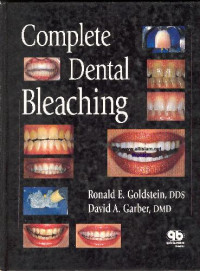 Ronald E. Goldstein, David A. Garber — Complete Dental Bleaching