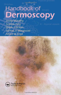 Josep Malvehy, Ralph P. Braun, Susana Puig, Ashfaq A. Marghoob, Alfred W. Kopf — Handbook of Dermoscopy