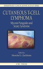 Herschel S Zackheim — Cutaneous T-cell lymphoma : mycosis fungoides and Sézary syndrome