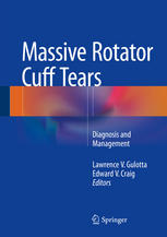 Lawrence V. Gulotta, Edward V. Craig (eds.) — Massive Rotator Cuff Tears: Diagnosis and Management