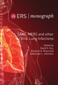 David S. Hui, Giovanni A. Rossi, Sebastian L. Johnston — SARS, MERS And Other Viral Lung Infections