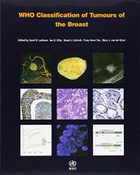 International Agency for Research on Cancer — WHO Classification of Tumours of the Breast