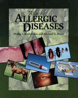 Fariba Behbod, Gailen D. Marshall Jr. (auth.), Phillip L. Lieberman MD, Michael S. Blaiss MD (eds.) — Atlas of Allergic Diseases