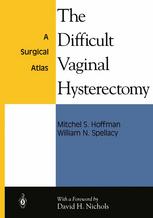 Mitchel S. Hoffman, William N. Spellacy (auth.) — The Difficult Vaginal Hysterectomy: A Surgical Atlas