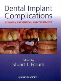 Stuart J. Froum — Dental Implant Complications: Etiology, Prevention, and Treatment
