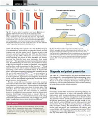 Neligan P. — Plastic Surgery. Volume 6 Hand. Part 3