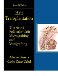 Barrera, MD Alfonso; Uebel, MD Carlos — Hair Transplantation : The Art of Micrografting and Minigrafting, Second Edition