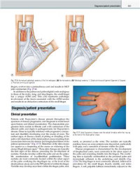 Peter C. Neligan — Plastic Surgery. Volume 6. Hand. Part 2