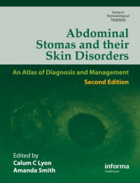 Calum Lyon, Amanda Smith — Abdominal Stomas and Their Skin Disorders, Second Edition (Series in Dermatological Treatment)