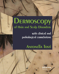 Antonella Tosti — Dermoscopy of hair and scalp disorders: with clinical and pathological correlations