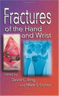 David C. Ring, Mark Cohen — Fractures of the Hand and Wrist