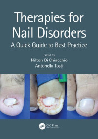 Nilton Di Chiacchio, Antonella Tosti — Therapies for Nail Disorders: A Quick Guide to Best Practice