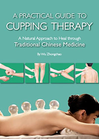Wu Zhongchao — A Practical Guide to Cupping Therapy