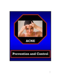  — Acne. Prevention and control