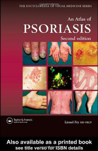 Lionel Fry — An Atlas of Psoriasis, Second Edition