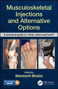 Maneesh Bhatia (Editor) — Musculoskeletal Injections and Alternative Options: A practical guide to 'what, when and how?'