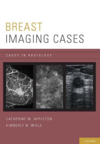 Catherine M. Appleton, Kimberly N. Wiele — Breast Imaging Cases (Cases in Radiology)