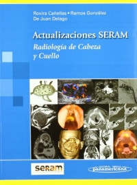 Alex Rovira Canellas, Ana Ramos Gonzalez, Manuel De Juan Delago — Actualizaciones SERAM: Radiologia De Cabeza Y Cuello