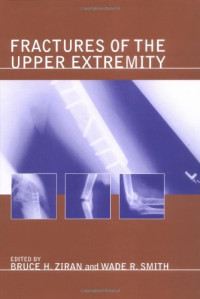 by Bruce H. Ziran (Editor) — Fractures of the Upper Extremity