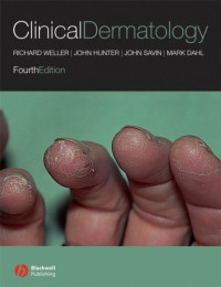 Richard Weller, John A. A. Hunter, John Savin, Mark Dahl — Clinical Dermatology, 4th edition