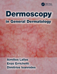 Aimilios Lallas, Enzo Errichetti, Dimitrios Ioannides — Dermoscopy in General Dermatology