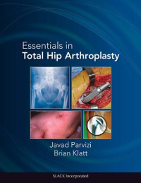 Javad Parvizi MD, Brian Klatt MD — Essentials in Total Hip Arthroplasty