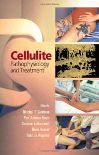 Mitchel P. Goldman, Gustavo Leibaschoff, Doris Hexsel, Pier Antonio Bacci — Cellulite Pathophysiology and Treatment