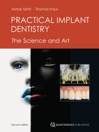 Ashok Sethi, Thomas Kaus — Practical implant dentistry: the science and art