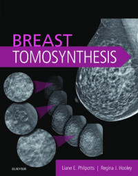 Liane E Philpotts MD  FACR, Regina J Hooley MD — Breast Tomosynthesis