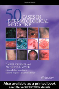 Daniel Creamer (ed.), Anthony du Vivier (ed.) — Fifty Cases in Dermatological Medicine