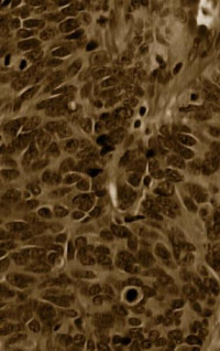 Driscoll B. — Lung Cancer: Diagnostic and Therapeutic Methods and Reviews