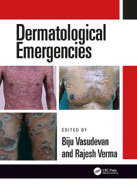 Rajesh Verma, Biju Vasudevan — Dermatological Emergencies