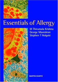 M Thirumala Krishna, George Mavroleon, Stephen T Holgate — Essentials of Allergy