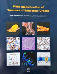 Ricardo V. Lloyd, Robert Y. Osamura, Günter Klöppel, Juan Rosai — WHO Classification of Tumours of Endocrine Organs