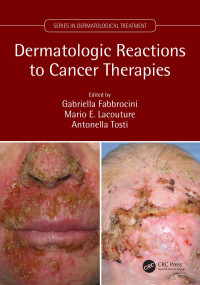 Gabriella Fabbrocini, Mario E. Lacouture; Antonella Tosti — Dermatologic Reactions to Cancer Therapies