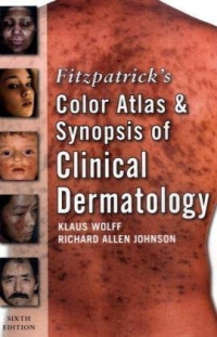 Klaus Wolff, Richard Allen Johnson — Fitzpatrick's Color Atlas and Synopsis of Clinical Dermatology, Sixth Edition