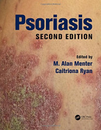 M. Alan Menter, Caitriona Ryan — Psoriasis 2nd Ed
