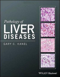 Gary C. Kanel — Pathology of liver diseases