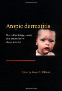 Hywel C. Williams — Atopic Dermatitis: The Epidemiology, Causes and Prevention of Atopic Eczema