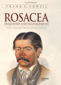 Frank Powell — Rosacea: Diagnosis and Management