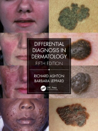 Richard Ashton, Barbara Leppard — Differential Diagnosis in Dermatology, 5th Edition