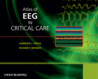 Lawrence J. Hirsch, Richard P. Brenner — Atlas of EEG in Critical Care