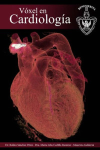 Sanchez Perez Ruben — Voxel en Cardiologia