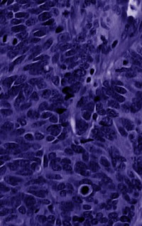 Driscoll B. — Lung Cancer: Molecular Pathology Methods and Reviews