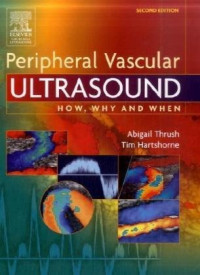 Abigail Thrush, Timothy Hartshorne, Abigail Thrush, Timothy Hartshorne — Peripheral vascular ultrasound: how, why, and when