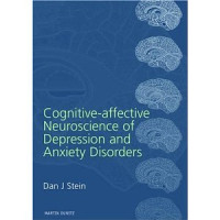 Dan J Stein — Cognitive-affective neuroscience of depression and anxiety disorders