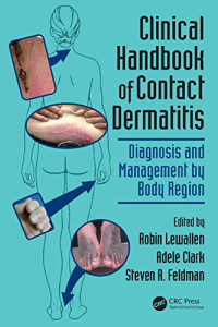 Robin Lewallen, Adele Clark, Steven R. Feldman — Clinical Handbook of Contact Dermatitis: Diagnosis and Management by Body Region