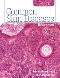 Motley, Richard — Common Skin Diseases